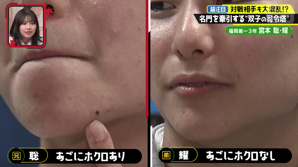 宮本聡選手と宮本耀選手の見分け方