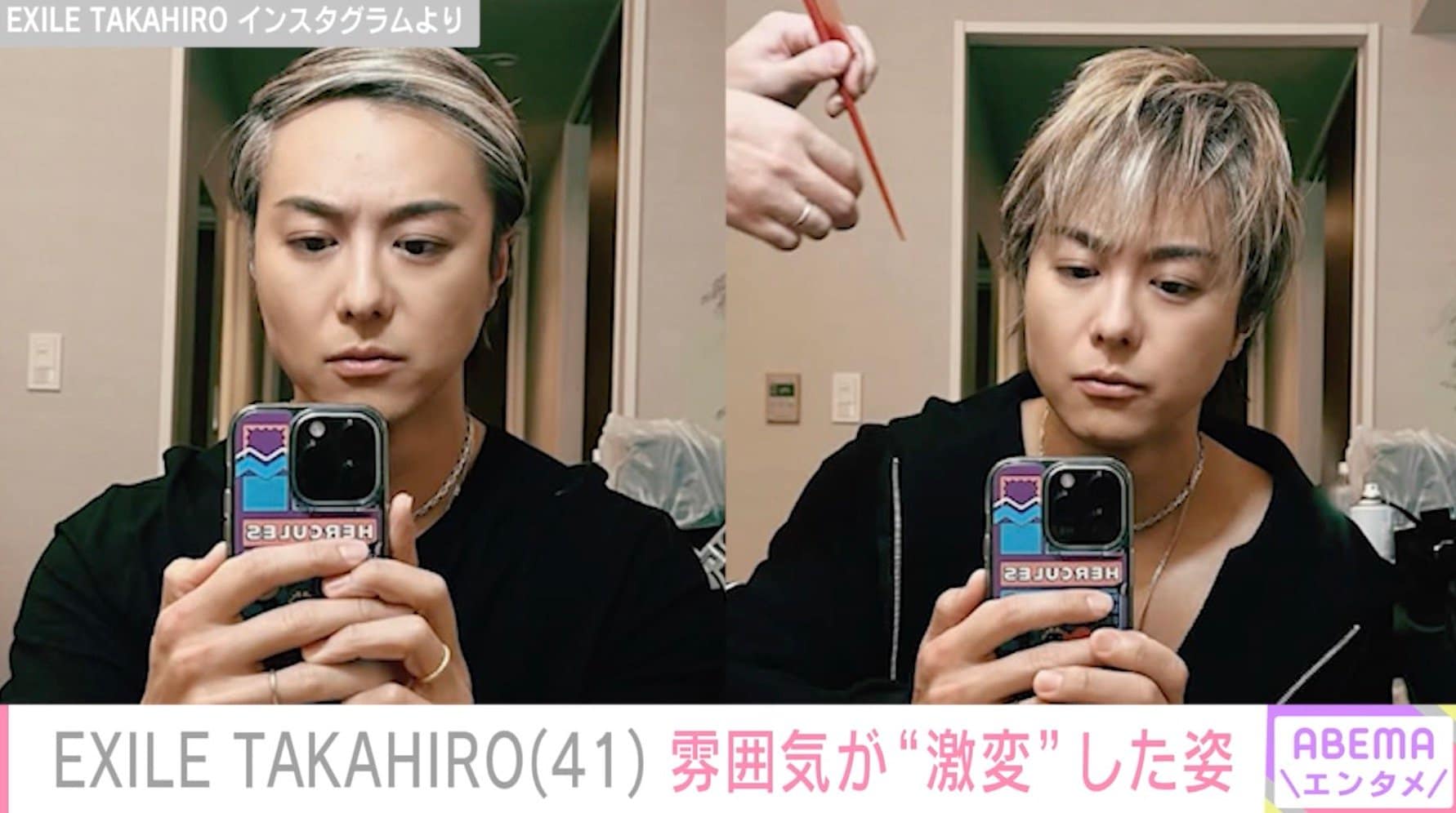 【写真・画像】EXILE TAKAHIRO、九一分けと前髪下ろしで「激変」ショット公開でファン驚き「ムロツヨシに似てない?」 2枚目