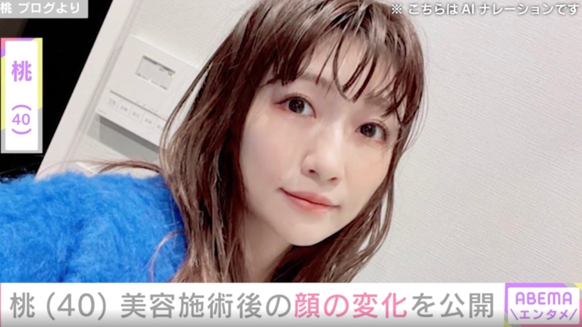 “3度の二重整形” 桃(40)、「顔が…ザラザラしています」美容施術後に現れた変化を公開