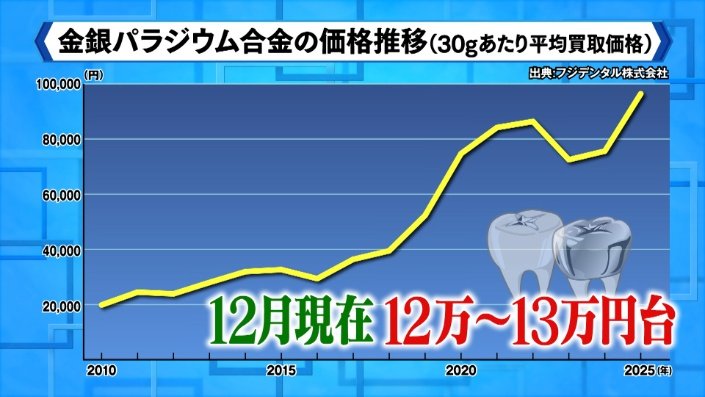 パラジウム合金値段推移