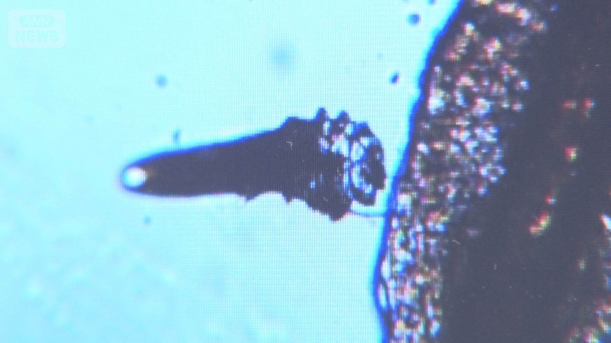 目のゴロゴロ「まつげダニ」？結膜炎＆ものもらい原因も　加齢とともに有病率が上昇