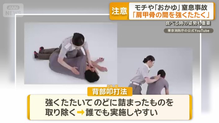 背部叩打（こうだ）法