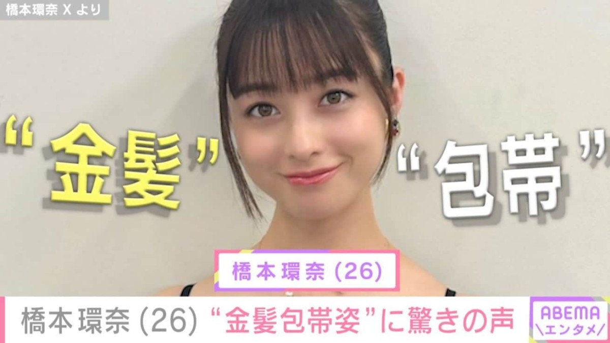 激変した姿が話題・橋本環奈（26）、“金髪包帯姿”に驚きの声「包帯ぐるぐるなのに顔面強すぎて草www」「バグってる」