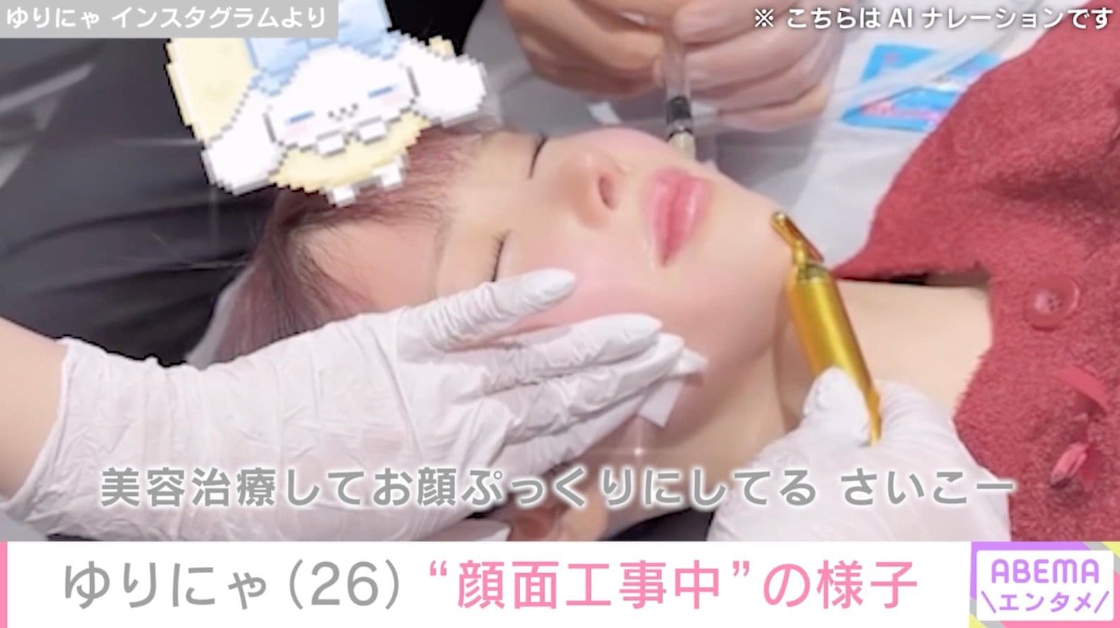 【写真・画像】3歳児ほどのウエストが話題 ゆりにゃ、“顔面工事中”の様子を公開「痩せたらコケたコケたってうるさいから」 2枚目