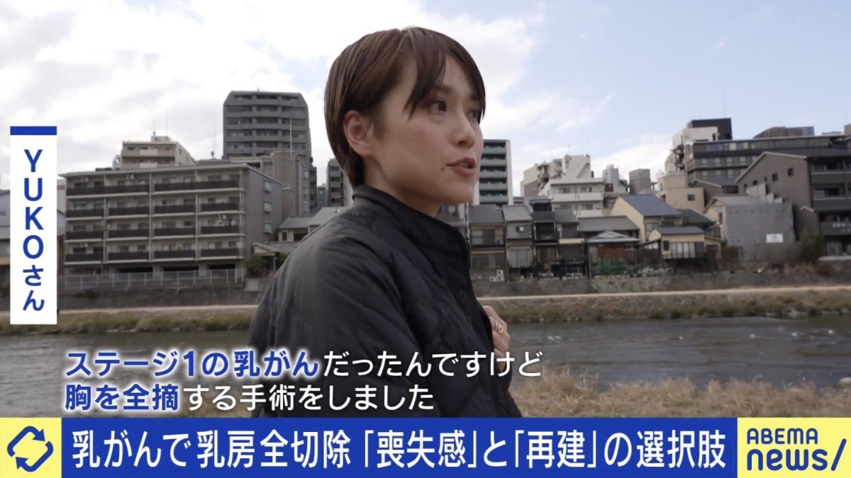 「女性らしさの象徴が胸。（乳房切除で）自分自身の喪失感を感じた」「見慣れなさ、違和感はある」乳がんで全切除した当事者に聞く葛藤