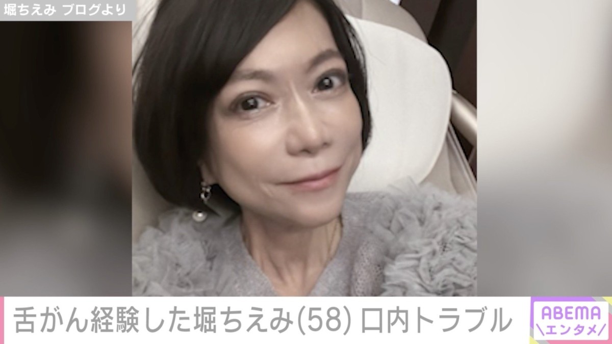 2019年に舌がん公表・堀ちえみ（58）、口内トラブルで治療へ「病のすべては口から」