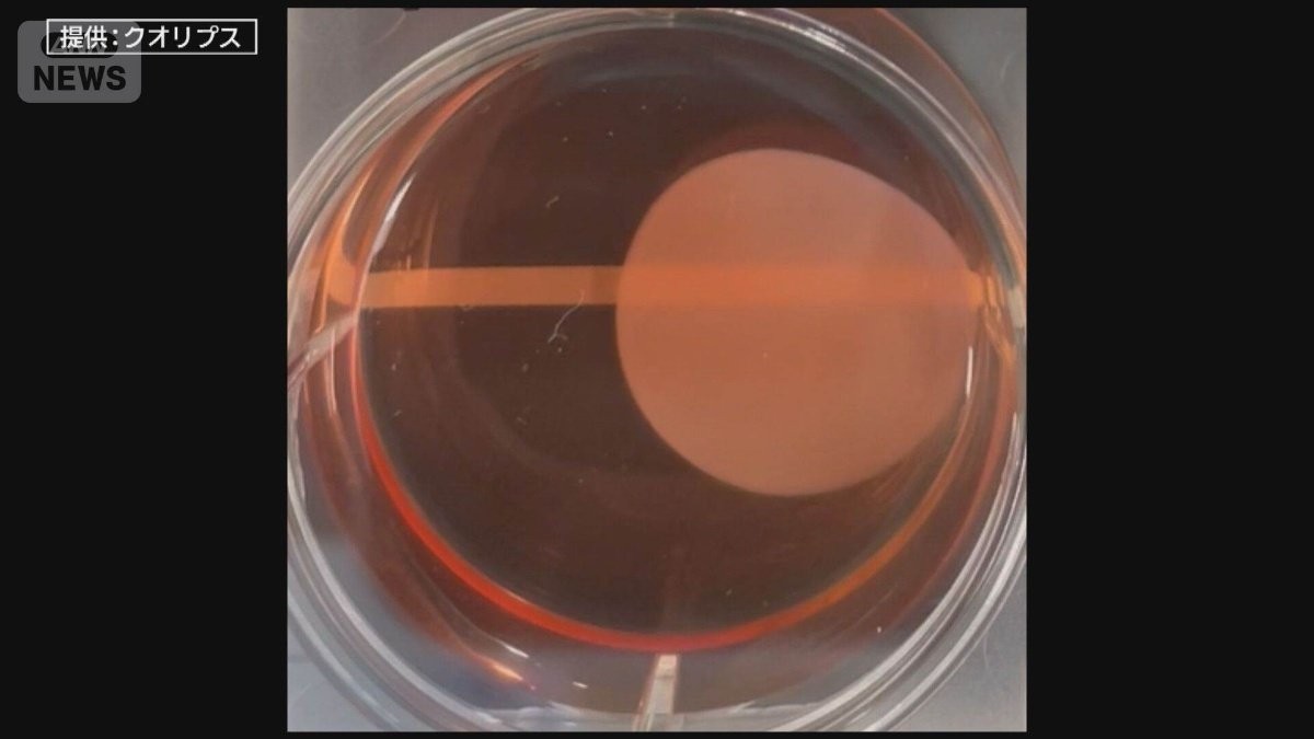 “仮免許”→“本免許”への道のりは？世界初『iPS細胞由来』条件付き承認へ