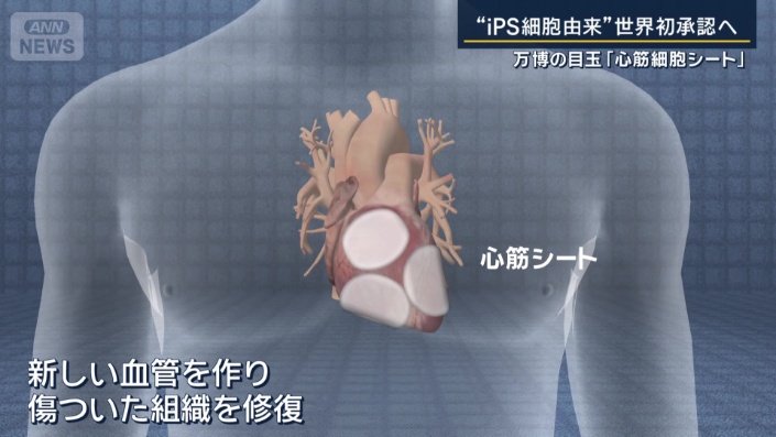 虚血性心疾患の患者