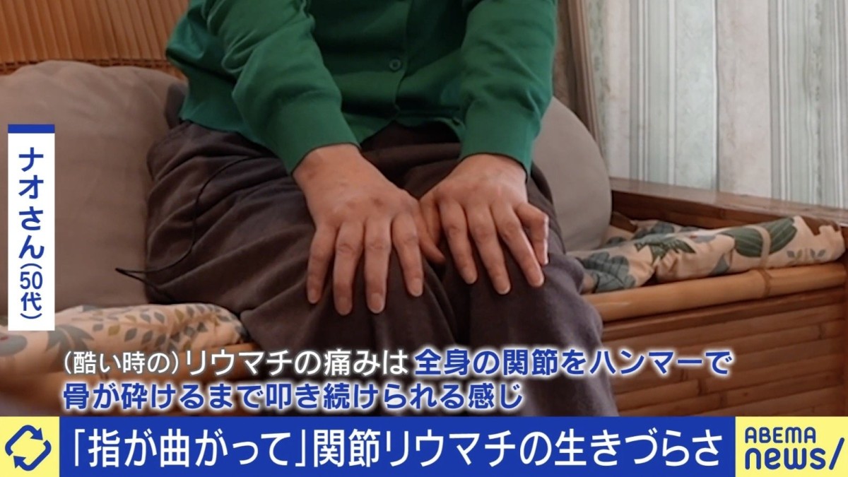 「電動ドリルでガリガリされる感覚」「関節を雑巾絞り」高市総理も苦しんだ関節リウマチ 当事語る生きづらさ
