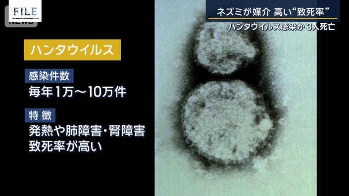 感染リスク