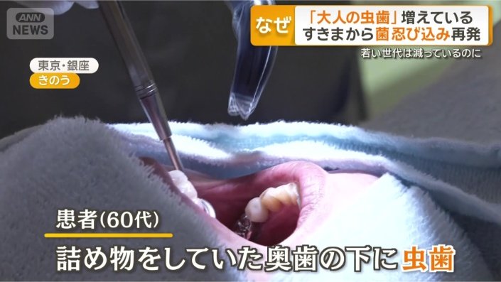 60代の患者