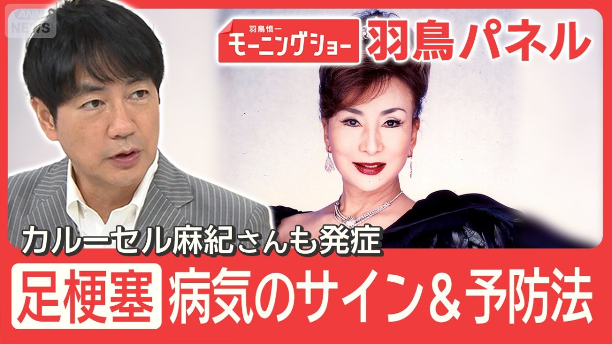 カルーセル麻紀さん発症『足梗塞』痛みで歩けず“切断寸前”に 病気のサイン＆予防法