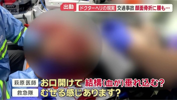 気道の中に出血が…