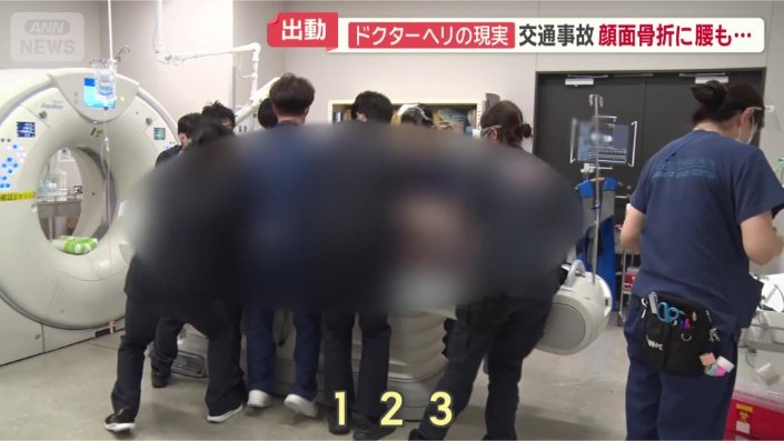 CT検査