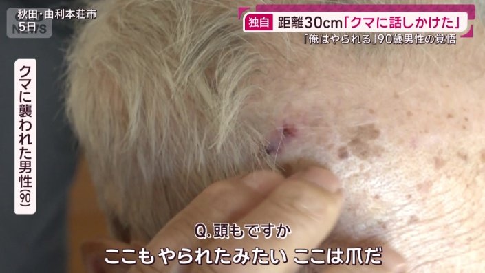 牙のあと