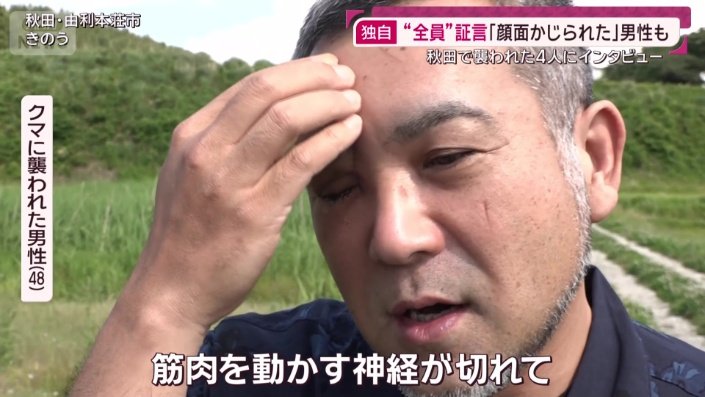 クマに襲われた男性