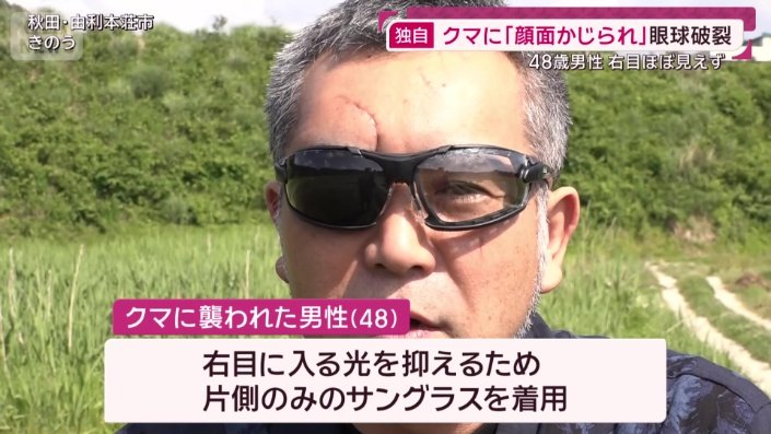 クマに襲われた男性
