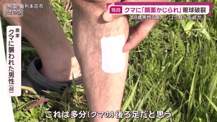 クマに襲われた男性