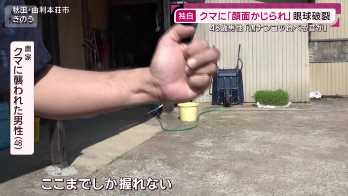 クマに襲われた男性