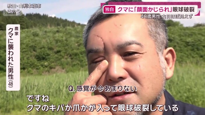 クマに襲われた男性