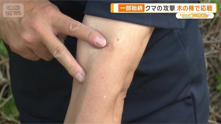 傷跡は今も…