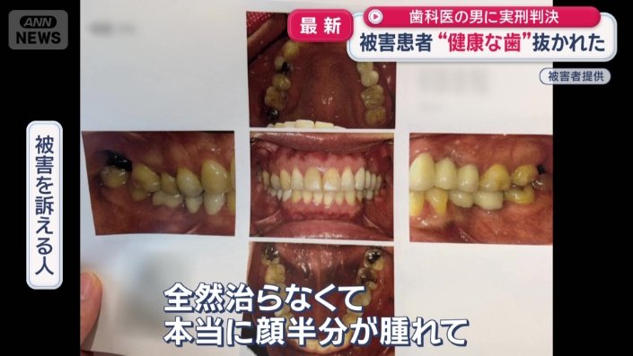 「顔半分が腫れて」
