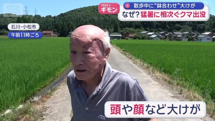 頭や顔などに大けが