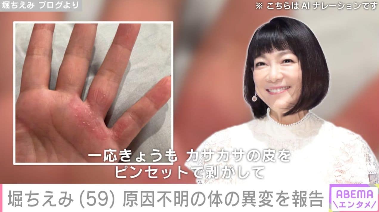 堀ちえみの手