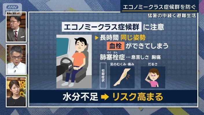 エコノミー症候群