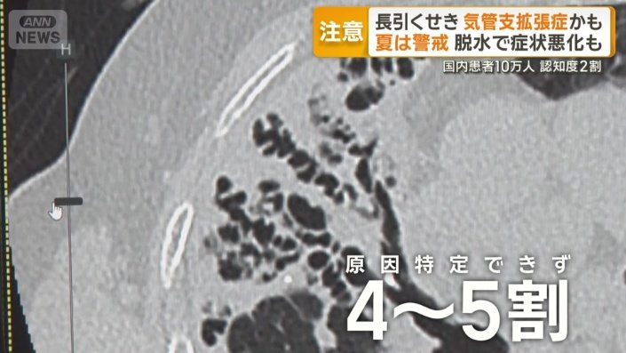 4〜5割は原因特定できず