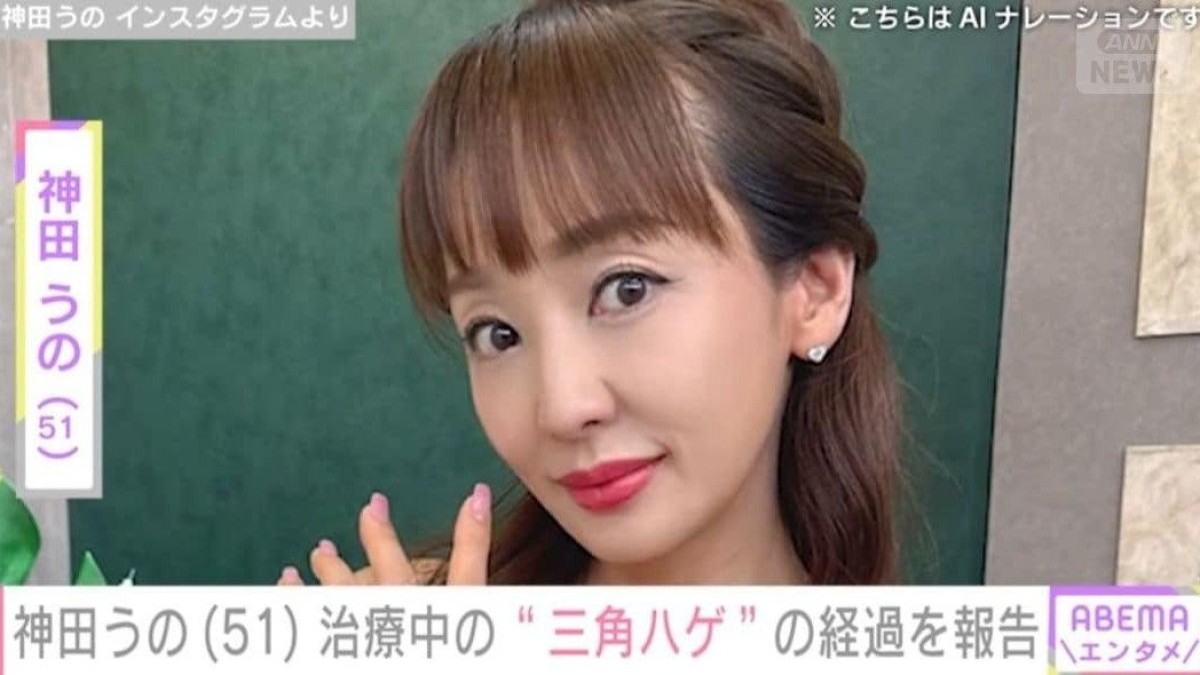 神田うの（51）、治療中の“三角ハゲ”の経過を報告